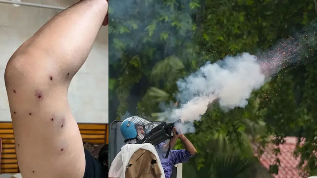 দিল্লিতে বিক্ষোভে ছররা গুলির অভিযোগ, হাসপাতালে মিলল ক্ষতচিহ্ন