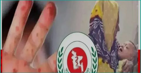 হাম ও উপসর্গে আরও ৫ শিশুর মৃত্যু, আক্রান্ত ১ হাজার ২৩২