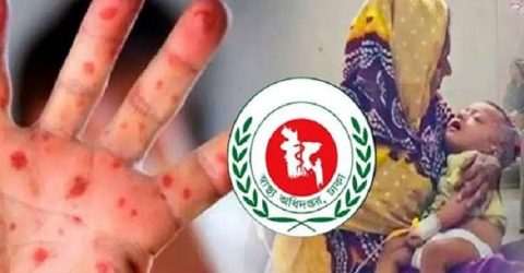 দেশে হাম ও উপসর্গে আরও ৮ জনের মৃত্যু
